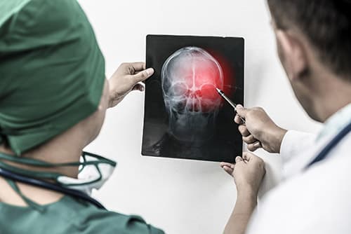 Personal Injury Law Firm for Neurological Injuries & Cases